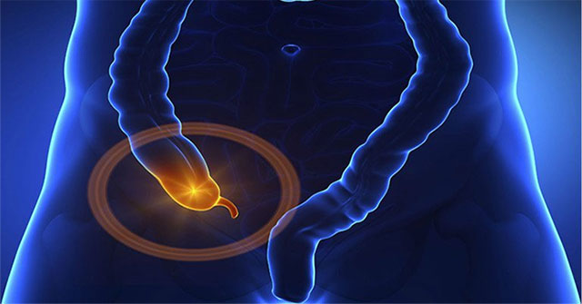 Small bowel obstruction: causes, symptoms and treatment