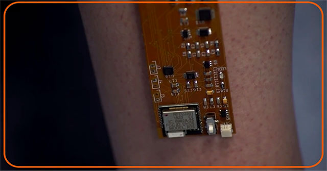 Smart bandages help patients recover from a distance