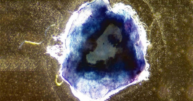 Successful research on biomaterials stronger than spider silk