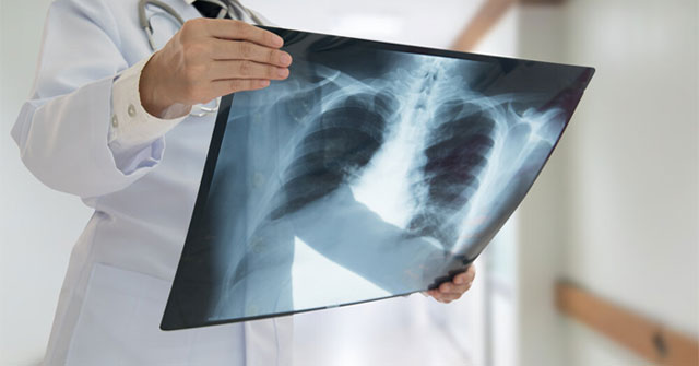 Successfully built the world's thinnest X-ray detector