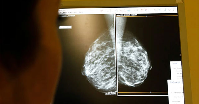 Sweden develops antibody with potential to treat cancer