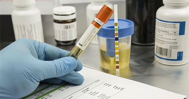 Testing equipment detects 40 types of drugs in just... 3 minutes