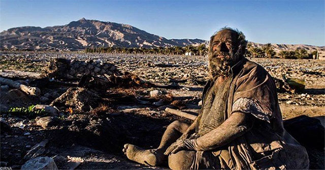 The doctor was surprised when he examined the old man's health for '67 years without a bath'