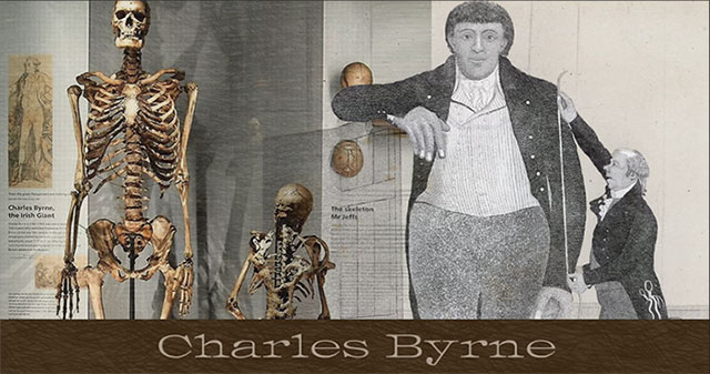 The Irish Giant: The Most Controversial Tragedy in British History