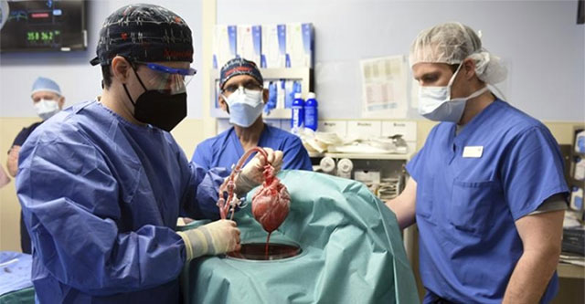 The US performed the first human pig heart transplant