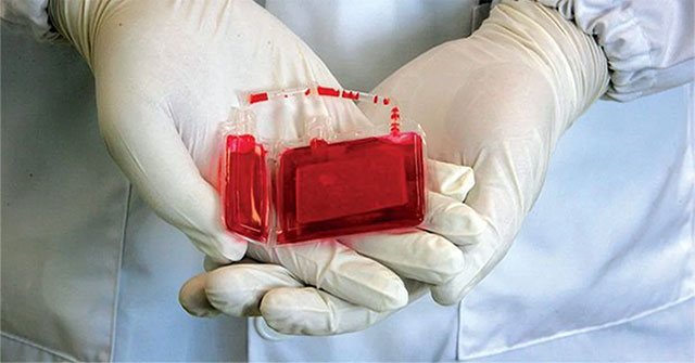 Things to know about stem cells from umbilical cord blood