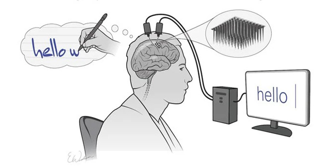Thought-to-text record has just been set with a new brain portal interface