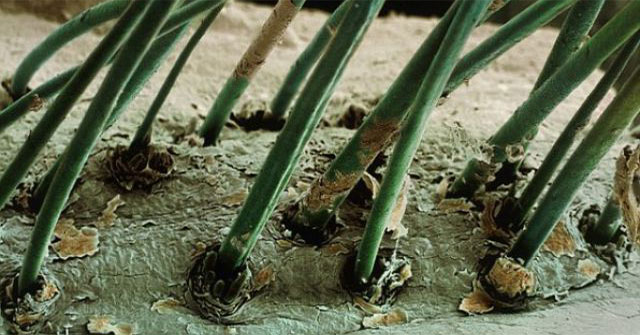 Top 25 common items that look different under a microscope