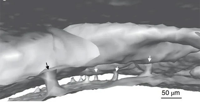 Unknown human body part discovered: 'Tunnel' in the brain