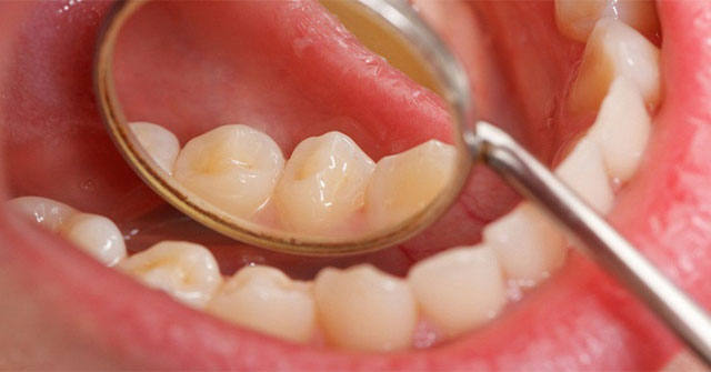 Warning signs of oral cancer