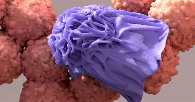 What happens to cancer cells after they die?