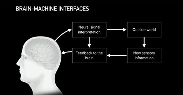 What is Neuralink? Can Neuralink 'cure' tinnitus as Elon Musk claims?