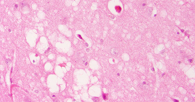Which infectious diseases have a mortality rate close to 100%?
