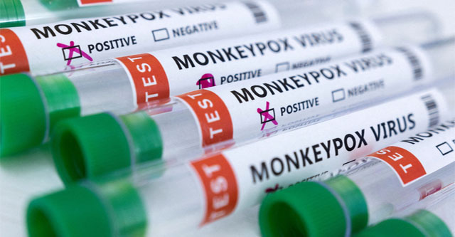WHO detects monkeypox virus in semen of patients
