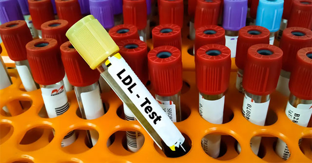 Why does veganism still increase cholesterol?