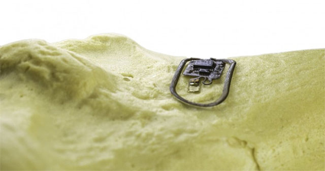 Wireless device that monitors bone health
