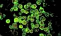10 deaths due to amoeba feeding on the human brain