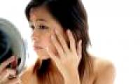 15 positions of acne warnings about health