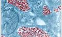 200 Indian children die from encephalitis