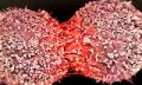 3 golden rules stop tumor formation in the body