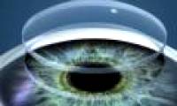 3D printing gets both corneas and implants successfully, people really come to the future