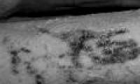 5.200-year-old mummy has the most powerful and ancient tattoo in the world