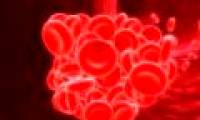 6 warning signs of dangerous blood clots