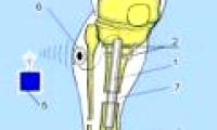 7 Medical progress is expected in 2013