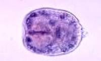 8 types of parasites are at risk of hiding in the food you eat every day