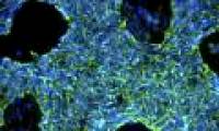A breakthrough in transforming skin cells into brain cells