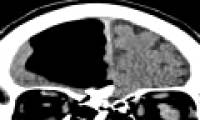 A lost '1/4' brain makes the doctor confused