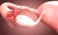 A strange phenomenon is extremely dangerous for women but not everyone knows