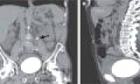 Abdominal pain, the man hospitalized for X-rays and obtained a frightening result