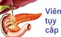Acute pancreatitis: Symptoms, treatments and prevention