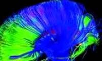 'Adjust the brain' to treat chronic pain