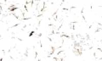 'Aggressive' drug-resistant malaria parasites spread throughout Southeast Asia