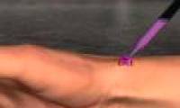America develops super chips that help heal wounds
