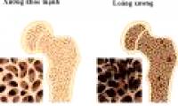America successfully recreates bones from stem cells