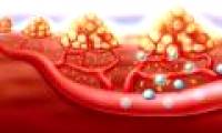 American scientists have found a way to prevent cancer from spread