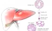 Announcing important findings about liver cancer