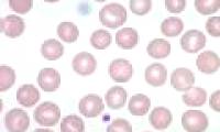 Announcing method to reverse leukemia