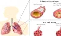 Application of stem cells in the treatment of chronic obstructive pulmonary disease