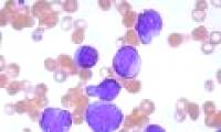 Art of seduction of leukemia