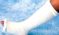Artificial bone made from wood