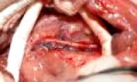 Austria successfully tested artificial blood vessels on mice