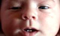 Baby girl was born smiling with 2 front teeth