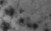Billions of viruses are falling on our heads every day without anyone knowing