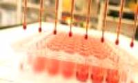 Blood test for early diagnosis of cancer with ... sound waves