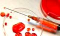 Blood test method helps detect cancer 5 years early