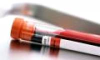 Blood tests can help detect lung cancer early